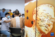 入伏首日 冬病夏治