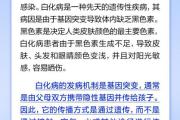 白化病是种传染病、一旦接触患者就会被感染？